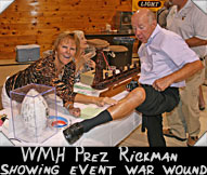 WMH President Ron Rickman shows event war wound